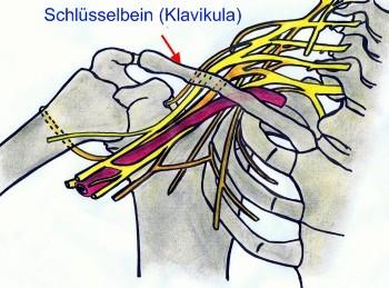 Das Schsselbein (Bild: www.operation-pro.de)