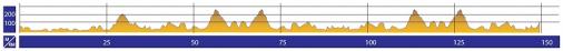 Hhenprofil Tour of Kuban 2015 - Etappe 2